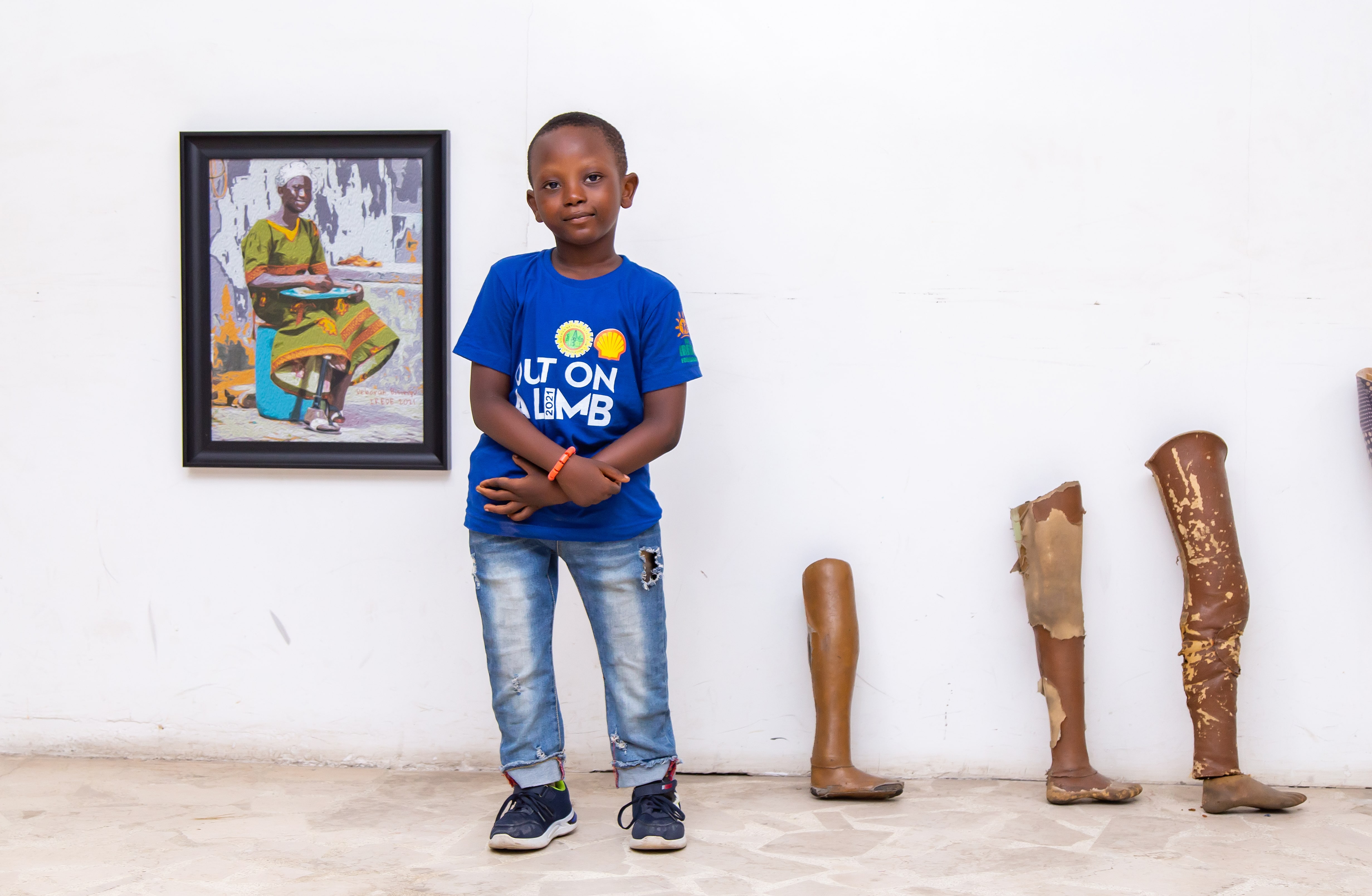 Crystal Chigbu: The mum making prosthetic limbs for Nigerian children